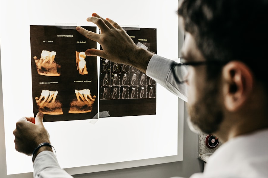 3D intraoral scan in progress
