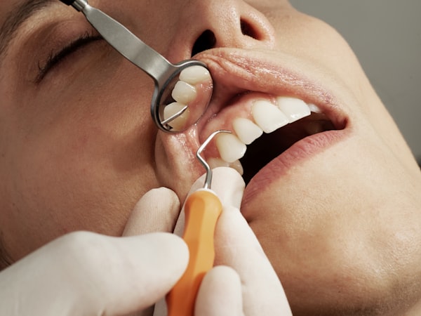Bright, healthy smile after whitening